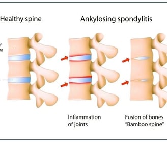 a diagram of a healthy spiner spiner