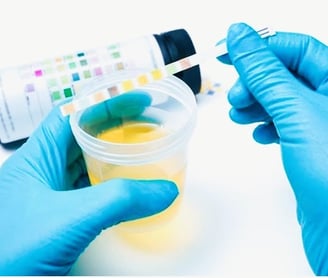 urine in lab