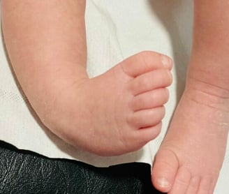 a baby's feet and toes on a white sheet