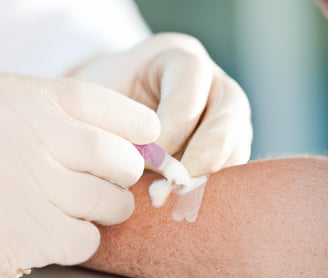 Superglue for wound care