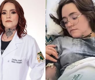 Espondiloartrite Axial e Neuralgia do Trigêmeo: A Luta de Carolina Arruda Contra a "Pior Dor do Mundo"