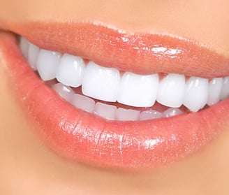 dentes brancos