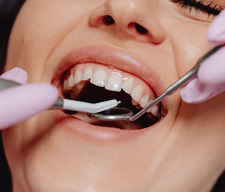Dentist carefully extracting a damaged tooth using dental instruments in a clinical setting