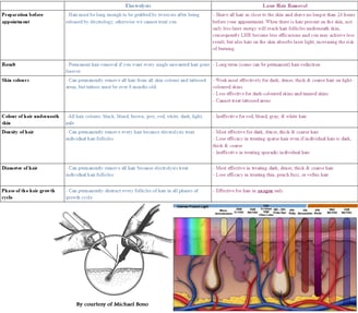 laser-vs-electrolysis