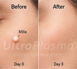 _ultra_plasma_ultra_plazma_ultra-plasma_ultra-plazma