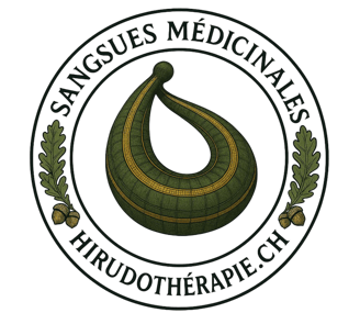 sangsue
