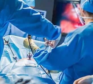 dr casuscelli effettuando intervento in laparoscopia