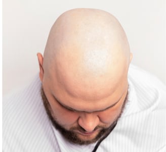 التحلل من الإحرام