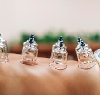 best Cupping Therapy In Kerala