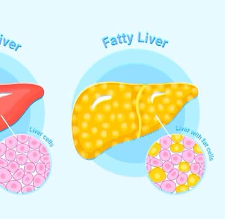 fatty liver