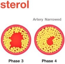 ldl and hdl cholesterol levels