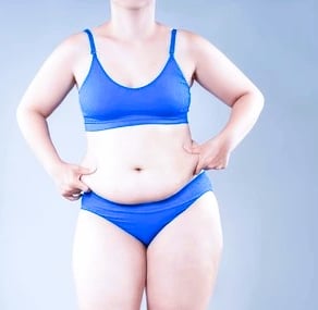 belly fat before after