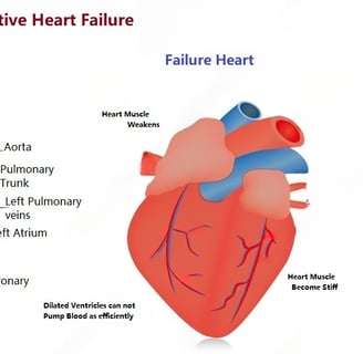 Congestive Heart Failure