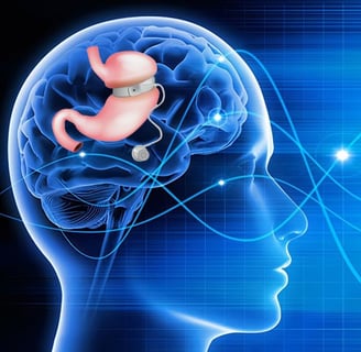 Hypnose anneau gastrique virtuel à Lyon 6ème : une approche innovante et non-invasive