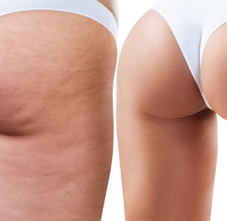 a woman with a very large butt buttocks