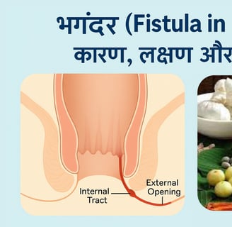 fistula treatment options