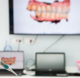 Scanner intraorale denti