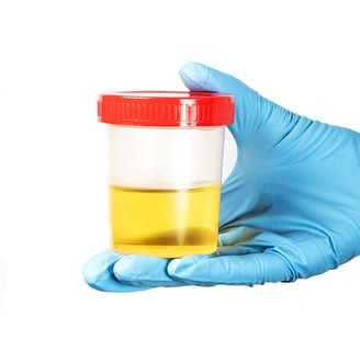 Urinary Tract Infection, Burning, Pee, Urine, Frequency, Antibiotics, Tests, Testing, UTI