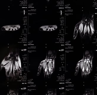 MRI dataset