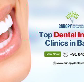 top dental implant in baner