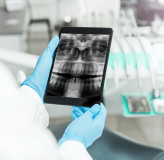 Implantologia dentale