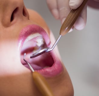 Limpeza dental completa