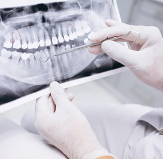 Planificacion de un implante dental
