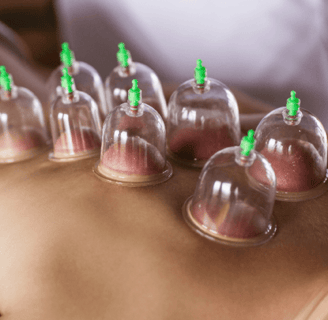 ventosa. ventosaterapia. medicina chinesa. terapia natural. tratamento de dores massagem com ventosa