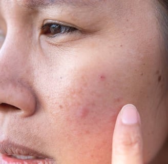 Reduce inflammation