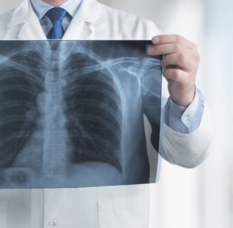 radiografia pulmones