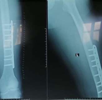 a pair of two pictures of a broken leg