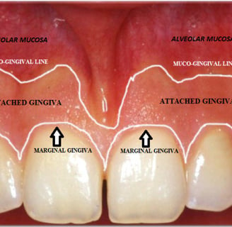 an image showing parts of gingiva