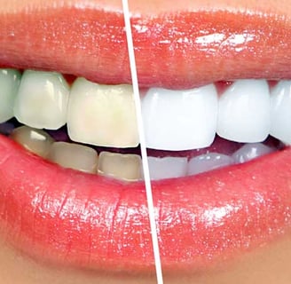 a image showing yellow teeth on one side and white teeth on other side