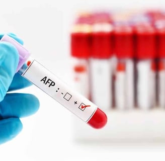 Alfa-fetoprotein (AFP) testi, karaciğer kanseri ve bazı diğer kanser türlerinin teşhis testidir.