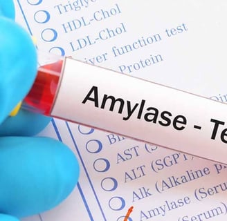 Amilaz ve lipaz testleri, pankreas fonksiyonlarını değerlendirmek için kullanılan kan testleridir.