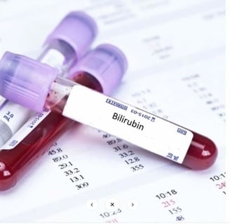Bilirubin testi, karaciğer sağlığını değerlendirmek ve sarılık gibi hastalıkları teşhis etmek için kullanılan kan testi