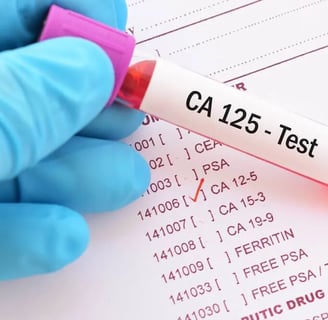 CA 125 testi, yumurtalık kanseri riskini değerlendirmek için kullanılan bir tümör belirteç testidir.