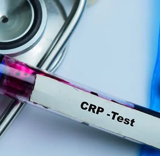 CRP Testi Nedir? Vücutta Enfeksiyon Belirtileri ve Sonuçlar