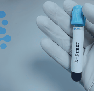 D-Dimer Testi Nedir? Pıhtılaşma Bozuklukları İçin Kullanımı