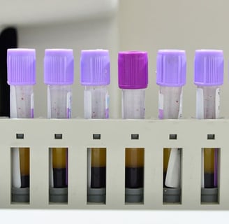 Tam Kan Sayımı (Hemogram) Test Sonuçlarını Doğru Okuma ve Yanlış Sonuçlara Dikkat!