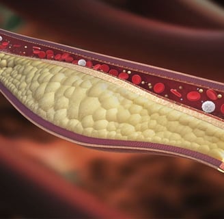 Kolesterol Testi Nedir? HDL, LDL ve Trigliserid Değerleri