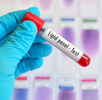 Lipit Paneli Nedir? Kardiyovasküler Sağlık İçin Testler