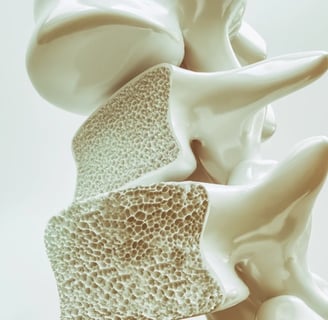 Osteoporoz, kemik yoğunluğunun azalması sonucu kırılgan hale gelmesine neden olan bir hastalıktır