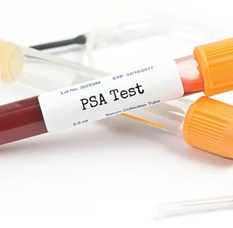 PSA Nedir? Prostat Sağlığı İçin Önemi ve Test Sonuçları