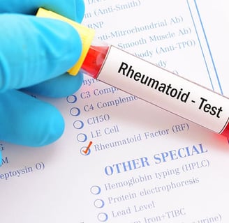 Romatoid Faktör (RF) Testi Nedir? Romatizma ve Tanı Yöntemleri