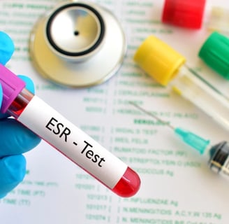 Sedimantasyon Nedir? Kan Testlerinde Yüksek ve Düşük Değerler