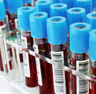 Serum kalsiyum testi, kemik, kas ve sinir sağlığını değerlendirmek için yapılan bir kan testidir.