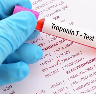 Troponin testi, kalp krizi ve kalp hastalıklarının teşhisinde kullanılan önemli bir kan testidir.
