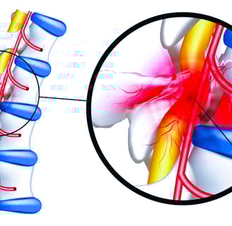 spinal cord injury