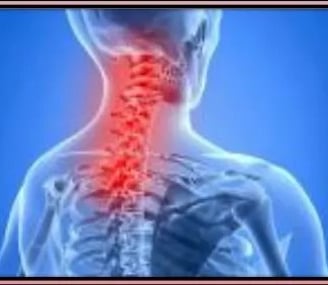7 Yoga Poses for Spondylitis
